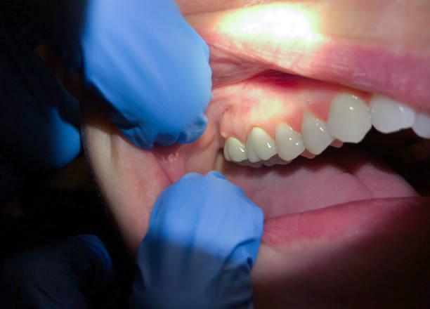 Best Emergency Denture Repair in Pelham, GA