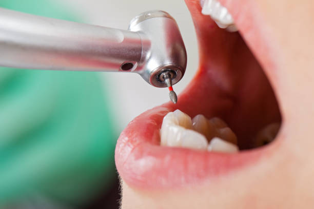 Best Emergency Treatment for Dental Infections or Abscesses in Pelham, GA